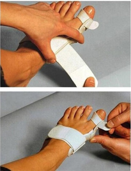 Hallux Valgus Foot Separator